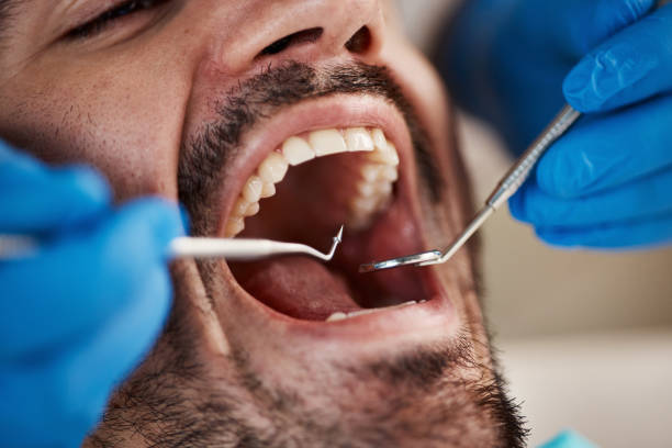 Best Emergency Dentist for Special Needs Patients in St Helens, OR