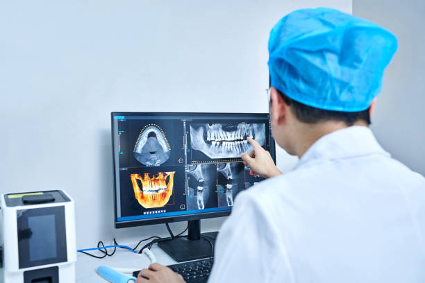 Best Emergency Dentist for Lost Fillings or Crowns in St Helens, OR